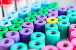 A bunch of colorful plastic caps sitting together